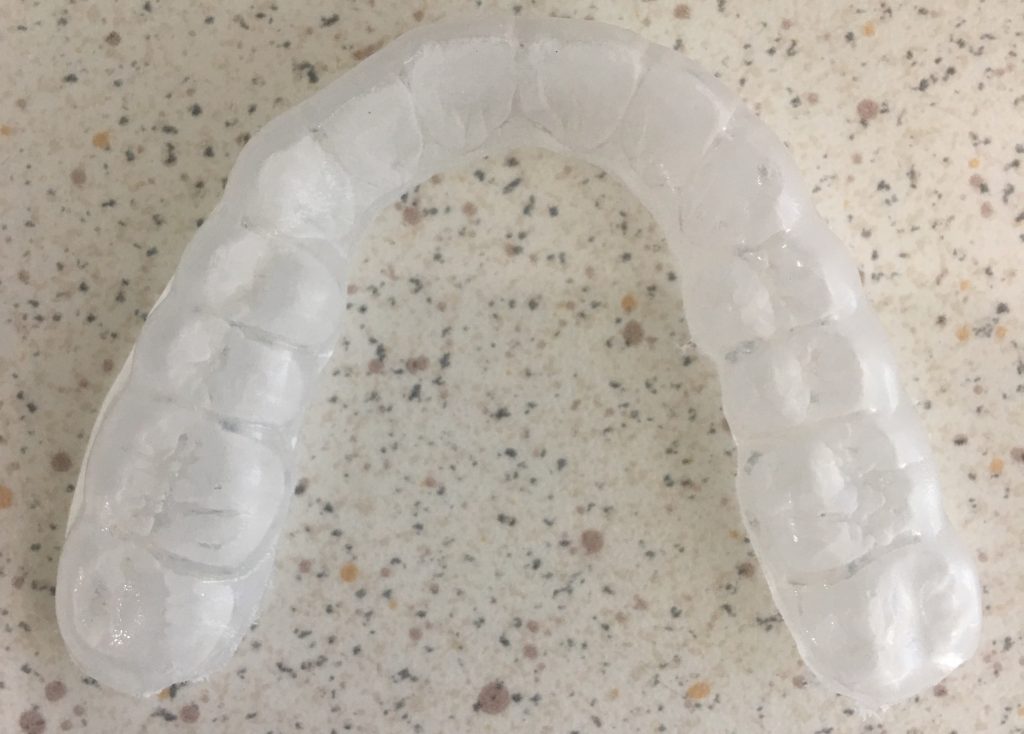 Do I Need A Retainer or a Night Guard? Dr Aaron Lai Klinik Pergigian