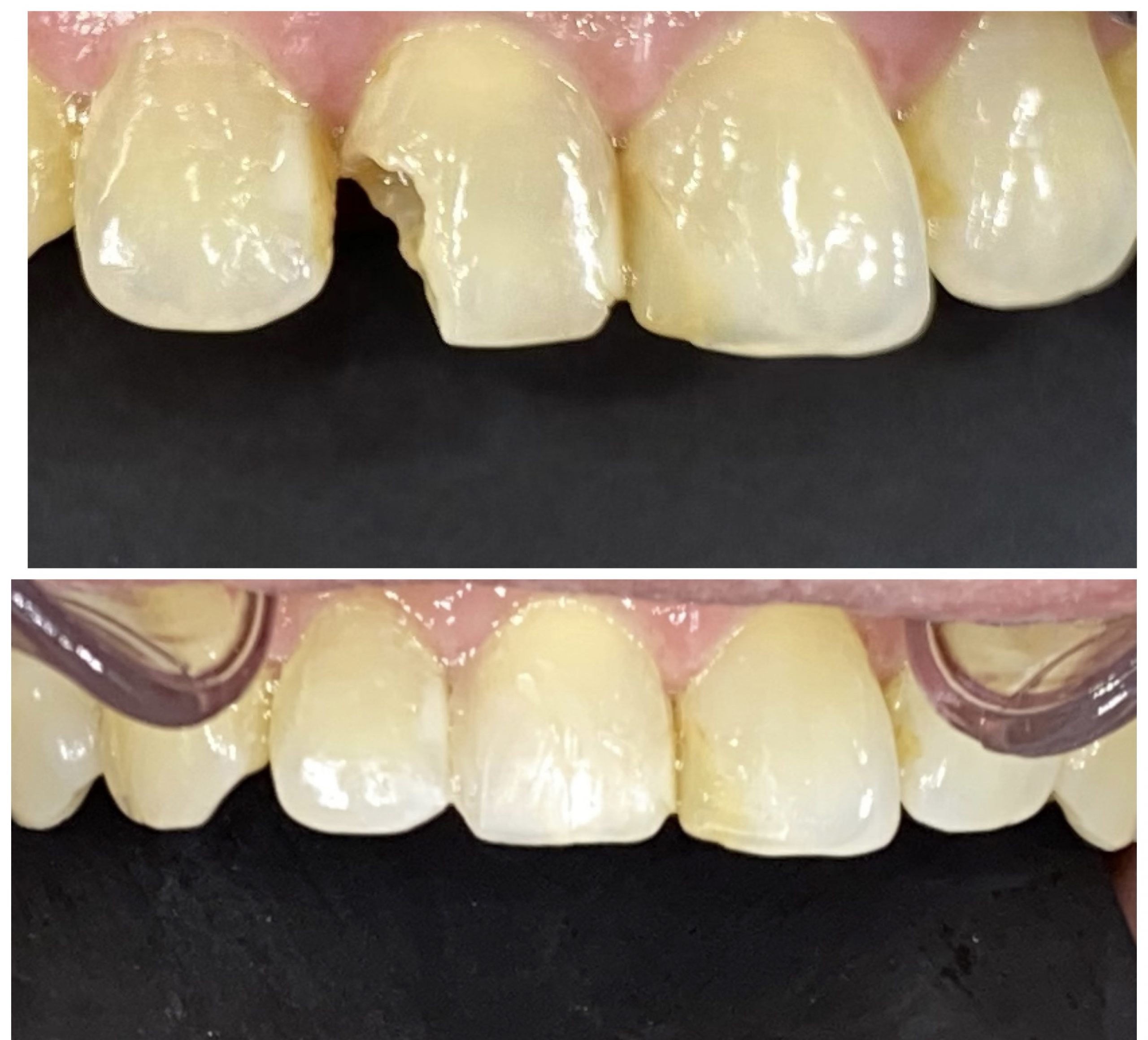 Doctor, I don’t feel confident when I smile….. can you help me? :Dr.Debbie